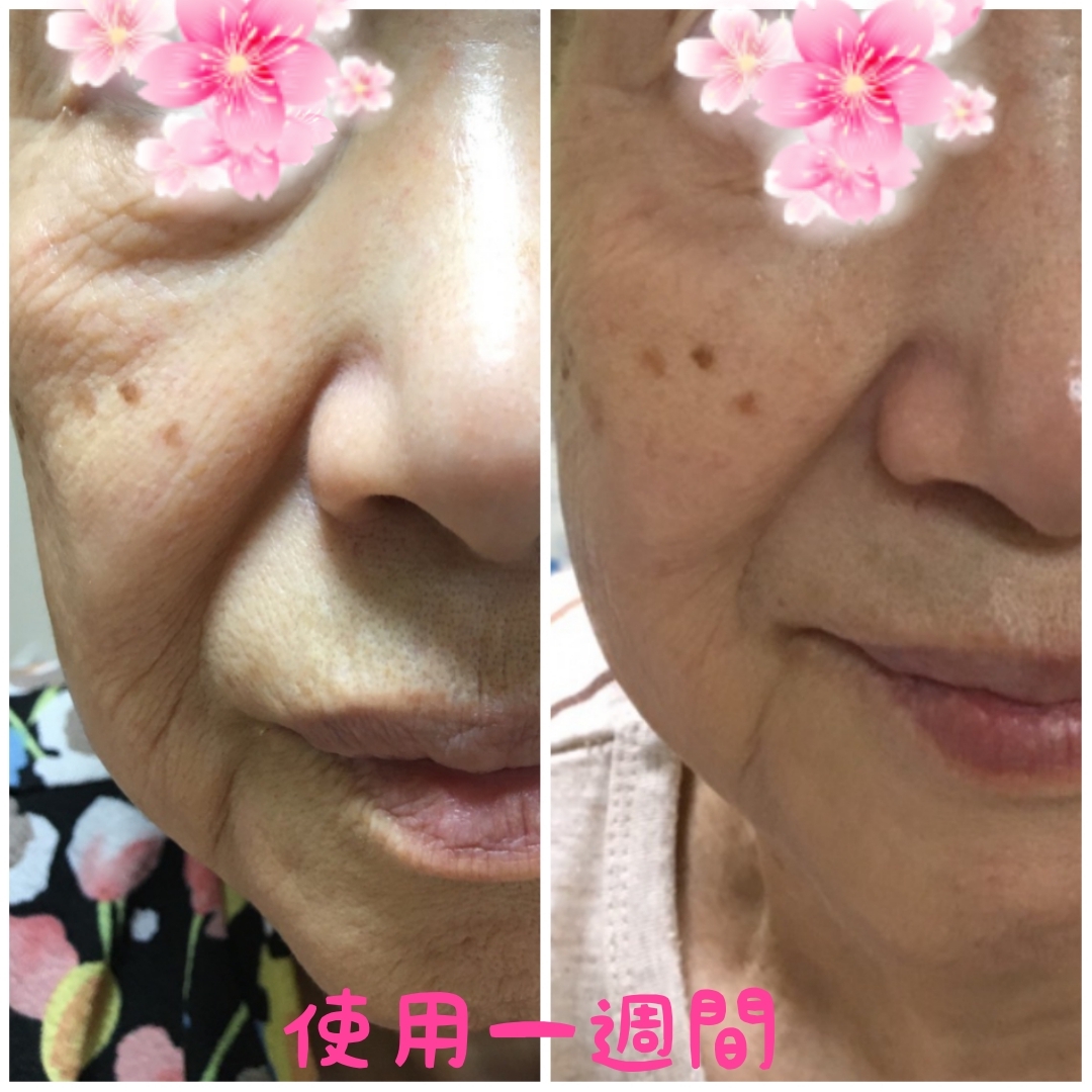ヒト幹細胞培養液🎵嬉しい報告 | BodyMakeちい リンパケア・痩身エステ