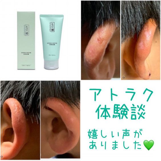 ヒト幹細胞培養液?嬉しい報告 | BodyMakeちい リンパケア・痩身エステ