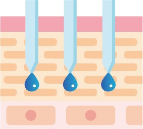 業界初！iPS・国際特許IMS・DERMA INJECTOR | 株式会社アドマッキャン