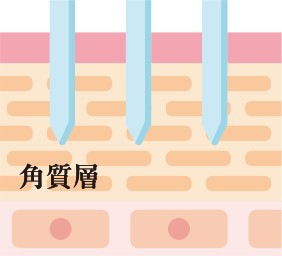 業界初！iPS・国際特許IMS・DERMA INJECTOR | 株式会社アドマッキャン