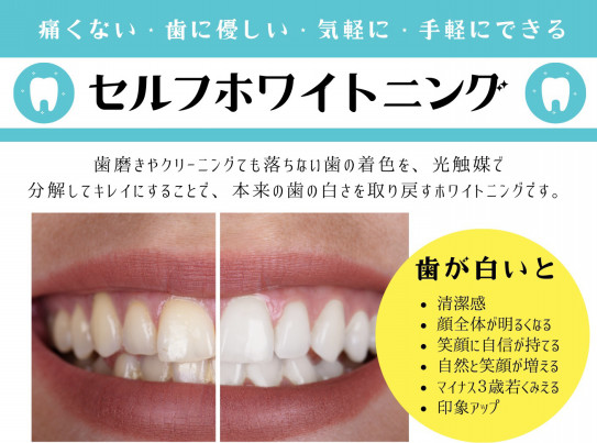 歯のエステ始めました！ | WELLNESS ˚✧₊BEAUTY˚✧₊