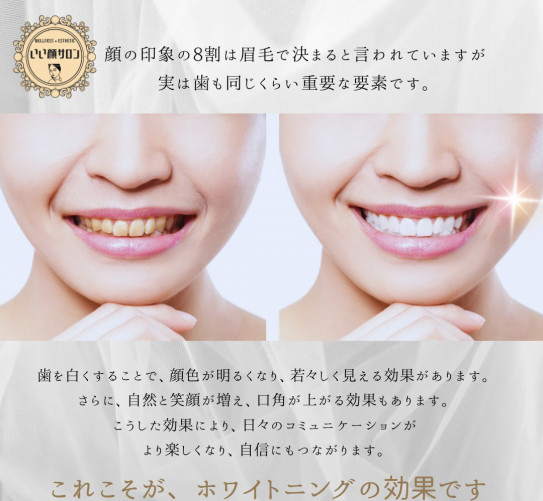見た目だけじゃない！？歯のホワイトニングの効果✨ | WELLNESS 