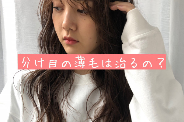 なおしたい ぱっくり分け目の薄毛が気になる Nyny梅田茶屋町店ブログ