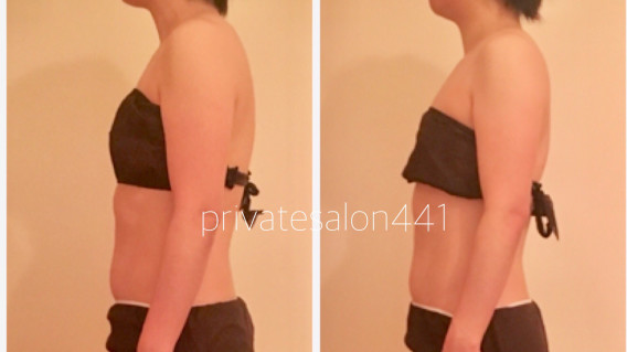 即効 背中痩せ 骨格美矯正 Privatesalon 441 即効 背中痩せ 骨格美矯正 Privatesalon 441