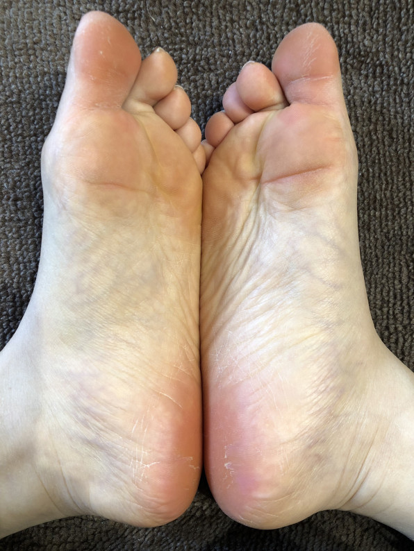 スタッフも足裏ケア O Rnk 爪屋