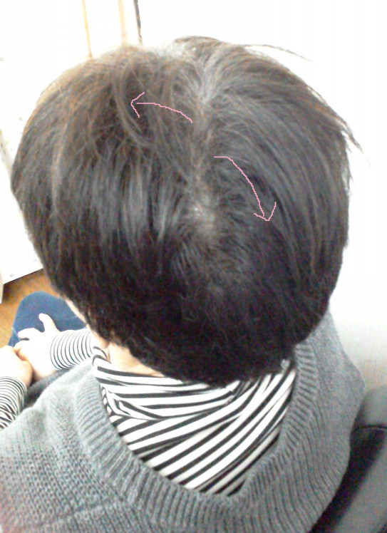 ツムジ部分でしっかり割れるクセと骨格の傾斜 美容室オンデマンド