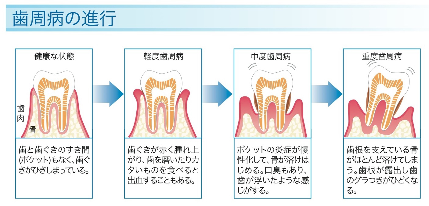 新価格版 修復処置を伴う歯周疾患治療 : treatment planning | www