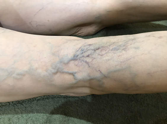 お灸の効果 北九州市小倉南区で鍼治療 あん摩マッサージ 美容鍼を受けるならメルシー鍼灸院 お灸の効果 北九州市小倉南区で鍼治療 あん摩マッサージ 美容鍼を受けるならメルシー鍼灸院