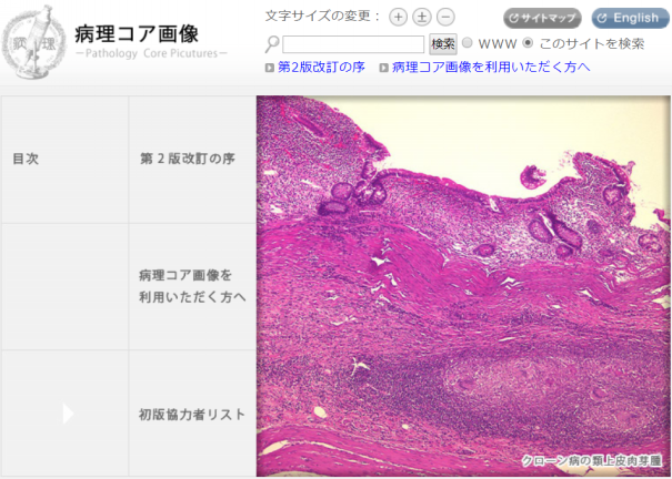 コア病理学 病理コア画像」という有能サイト | 病理情報ポータル