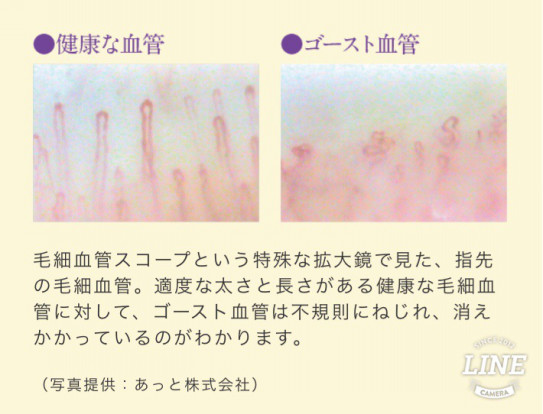 ゴースト血管 アロマトリートメントサロンlapilus ゴースト血管 アロマトリートメントサロンlapilus
