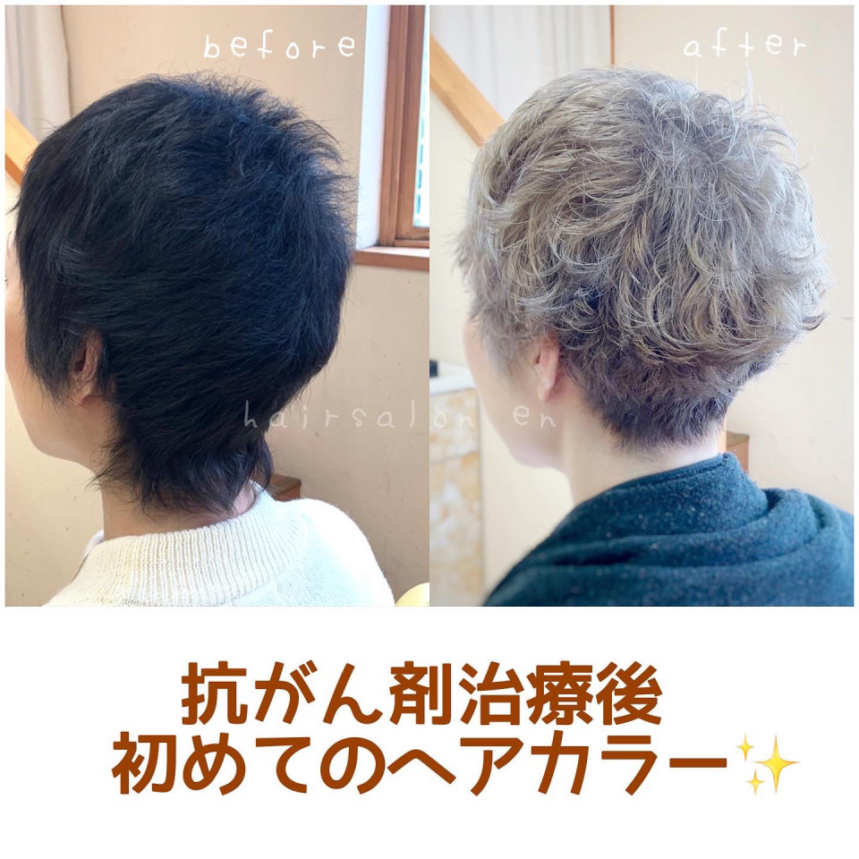 抗がん剤治療をした後の髪型 髪質 髪色について Q Aより