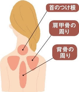 肩甲骨がゴーリゴリ Slur 千葉 錦糸町 美ボディと健康をダイエットなしで手に入れる