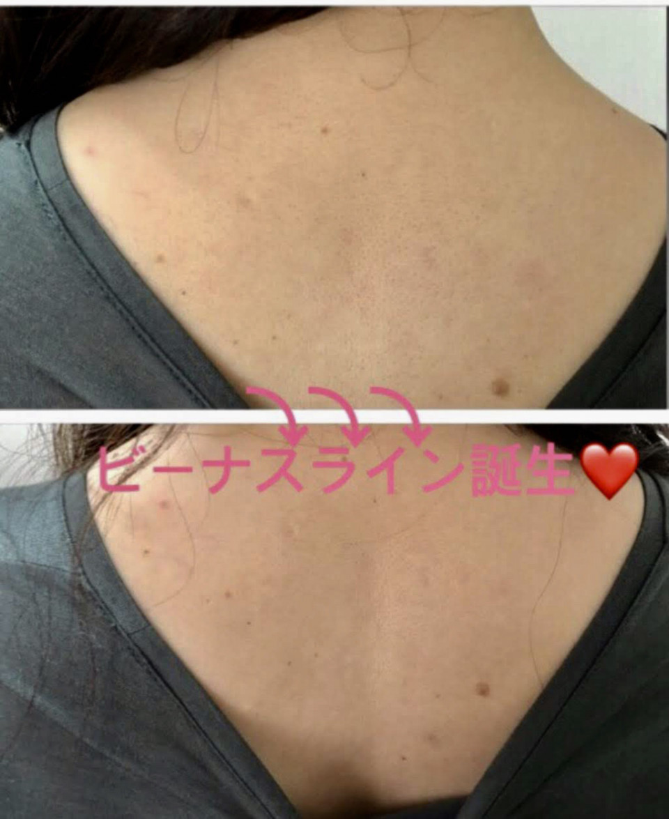美しいビーナスラインのために必要なこと Slur 千葉 錦糸町 美ボディと健康をダイエットなしで手に入れる 美しいビーナスラインのために必要なこと Slur 千葉 錦糸町 美ボディと健康をダイエットなしで手に入れる