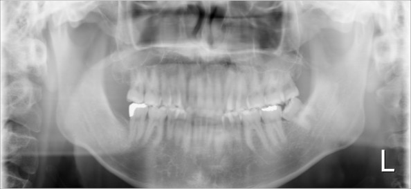 パノラマx線写真と頭部x線規格写真 セファロ は必須 正しい歯並び かみ合わせを手に入れましょう