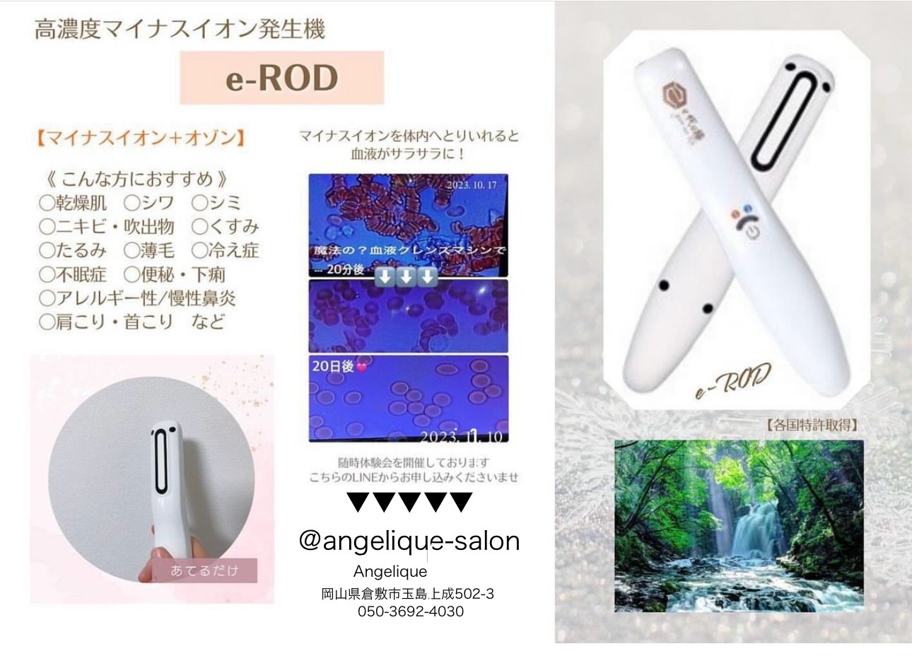 サンテクレアール フローライト5本 （サンテクレアール 乳酸菌