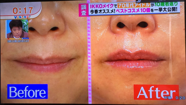 Ikkoさんがテレビで紹介 Jin S Beauty Innovation