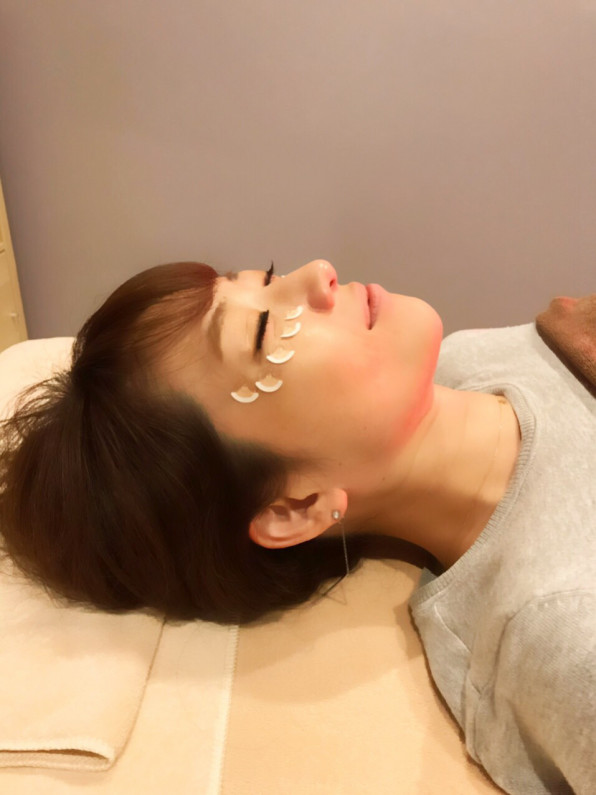 目の下のくすみやシワに円皮鍼 葛飾区立石駅のトータル鍼灸ケア ー リフトアップ美容鍼灸サロン Liftal リフタル