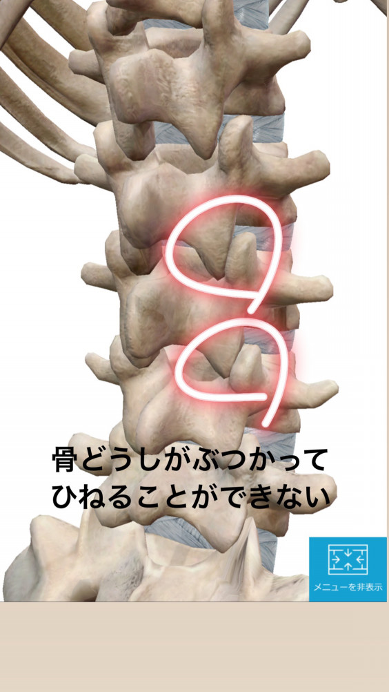 腰をひねってギックリ腰に ひねるから悪いのです 当たり前です なぜ 中村鍼灸院広島院