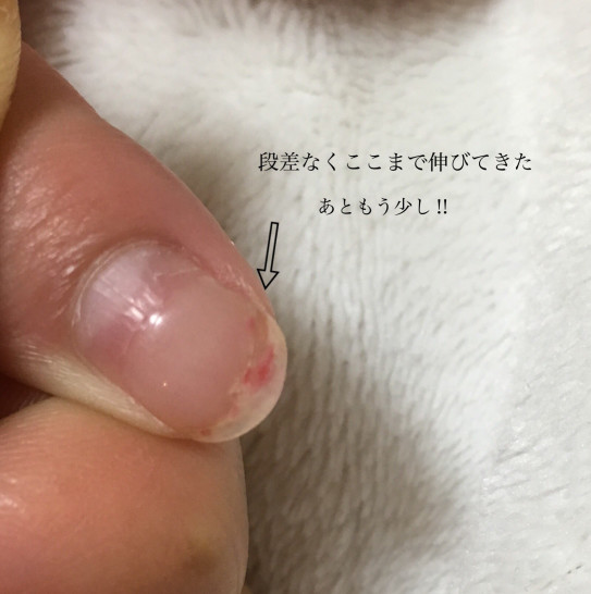 爪の補強 草加ネイルサロン K Style 爪の補強 草加ネイルサロン K Style
