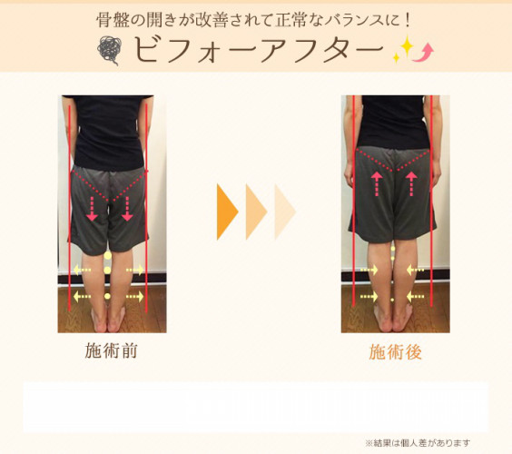 産後の骨盤の開きは脚と姿勢も重要 新宿美容整体 美容整体サロン ボディメイクスタイル 産後の骨盤の開きは脚と姿勢も重要 新宿美容整体 美容整体サロン ボディメイクスタイル