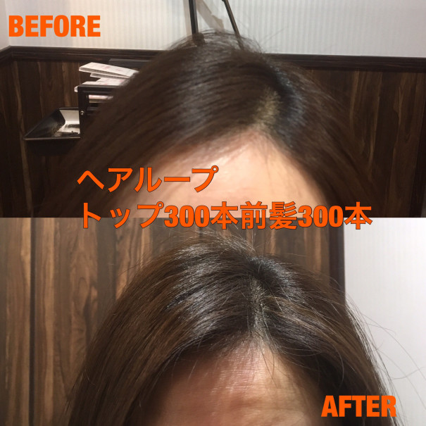 大人気メニュー ヘアループ Kenta Ushirono