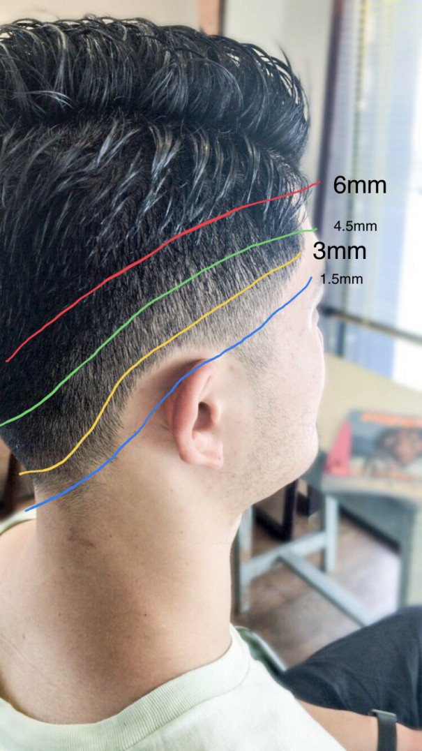 バリカンワーク 48時間目 Hair Com バリカンワーク 48時間目 Hair Com