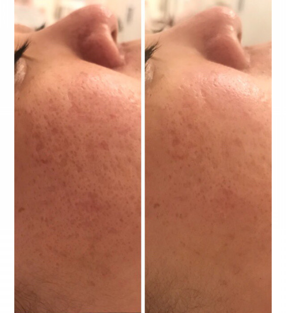 ビフォーアフター Beauty Salon K