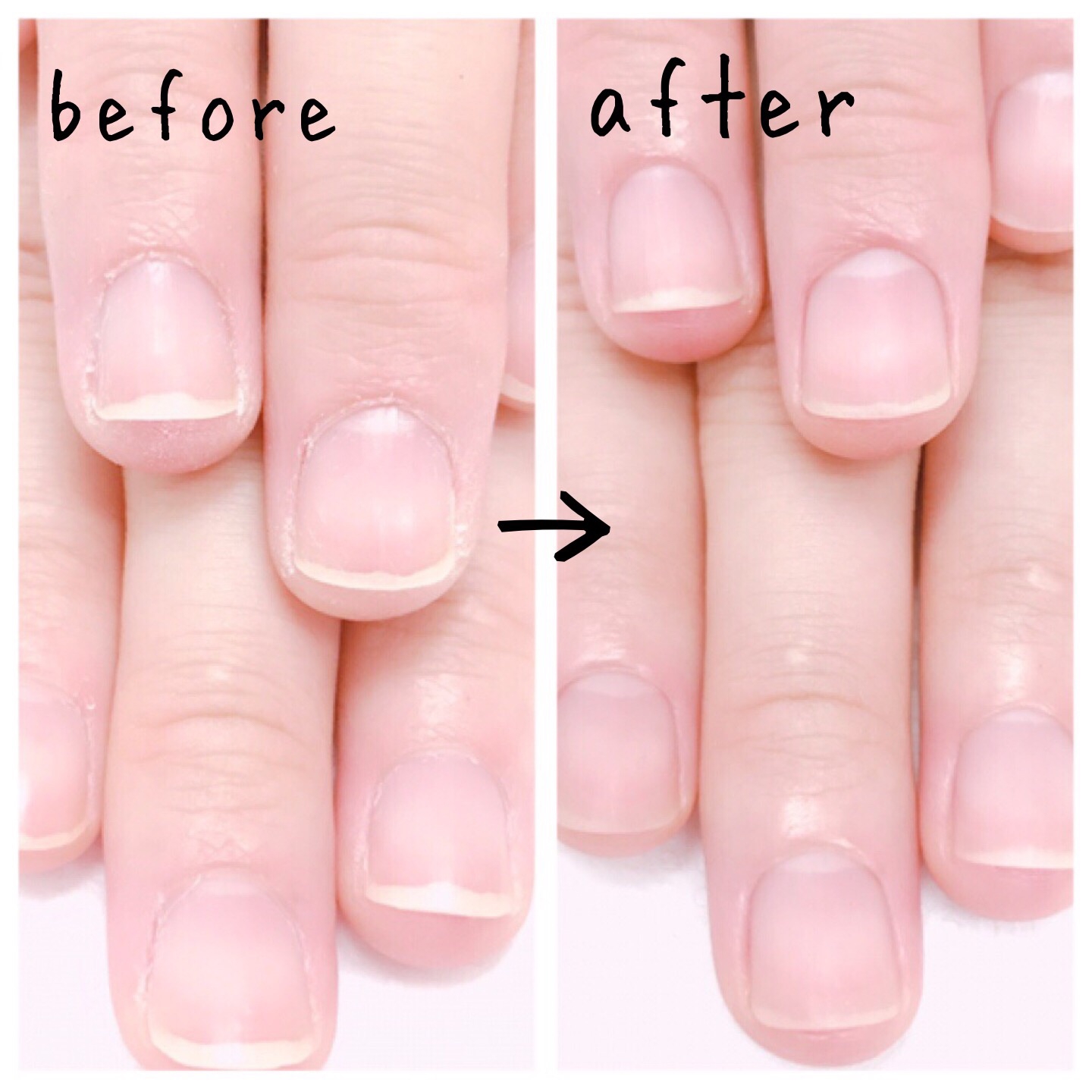 before & after nail care salon GROWTH