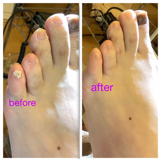 爪カット ﾌｯﾄﾊﾞｽ 爪ｶｯﾄ 大切な足のために 足と爪のケアは生涯歩行への第一歩です