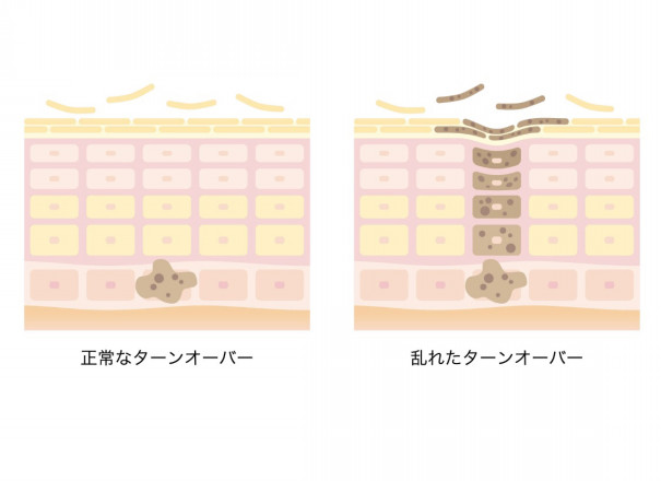 真冬の乾燥肌にもお顔そり 吹田 大阪 北摂 女性のためのお顔そり お顔そり美容法 ヘアーサロンファミリー 中野ひろみ