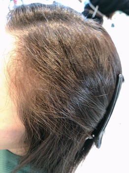 また 暑くなってクセも気になるのでは Infis 銀座