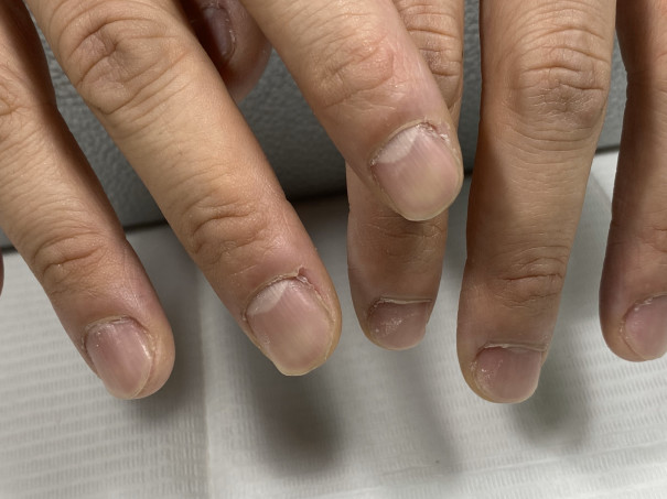 メンズネイルケア 鳥取県中部湯梨浜町 古民家 リラクゼーションサロン Kira Coeur キラクール ナンバーエイトネイル