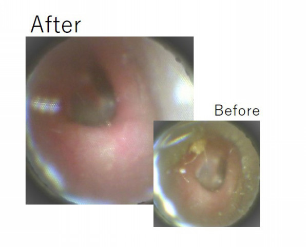 施術事例 耳掃除大好きなお客様 Mimi専科 見える耳掃除サロン みみせんか Jeb認定イヤーエステサロン