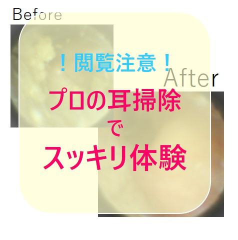 耳掃除しなかったらどうなる 3ヶ月でこれだけ溜まりました Mimi専科 見える耳掃除サロン みみせんか Jeb認定イヤーエステサロン 耳掃除しなかったらどうなる 3ヶ月でこれだけ溜まりました Mimi専科 見える耳掃除サロン みみせんか Jeb認定イヤーエステサロン