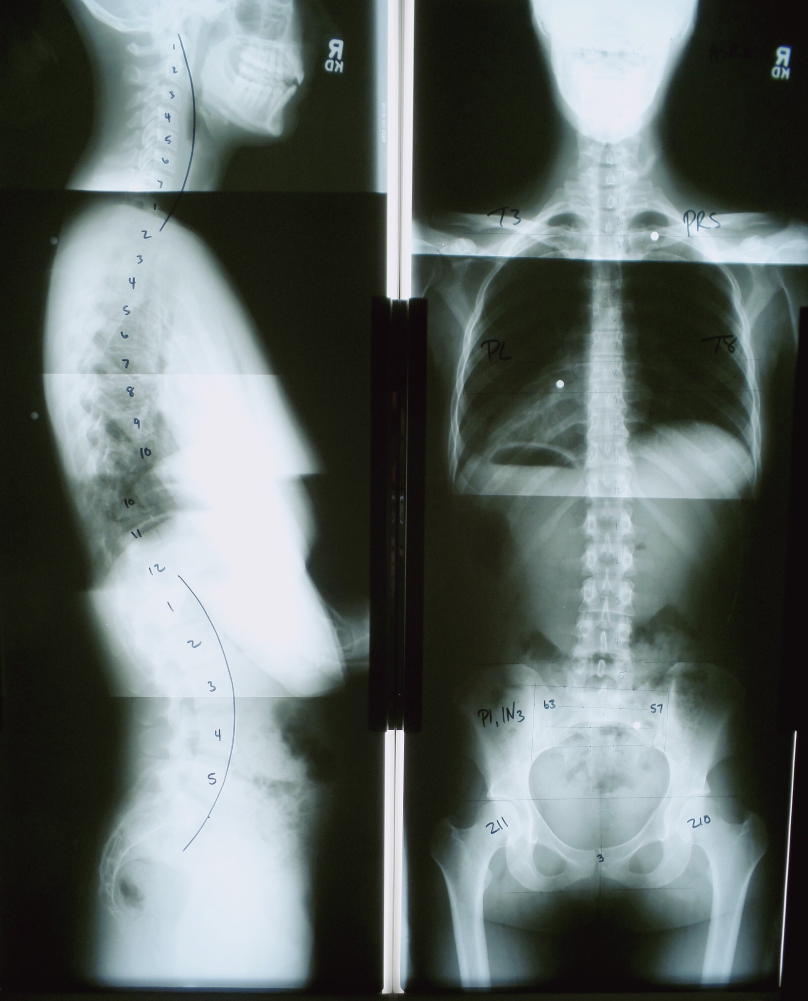 骨関節の画像診断１．２ ヨーカム カイロプラクティック 画像診断学 