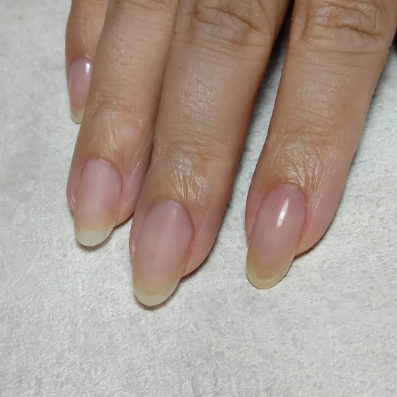 自爪風ネイルとは Nail Vesiplaneetti