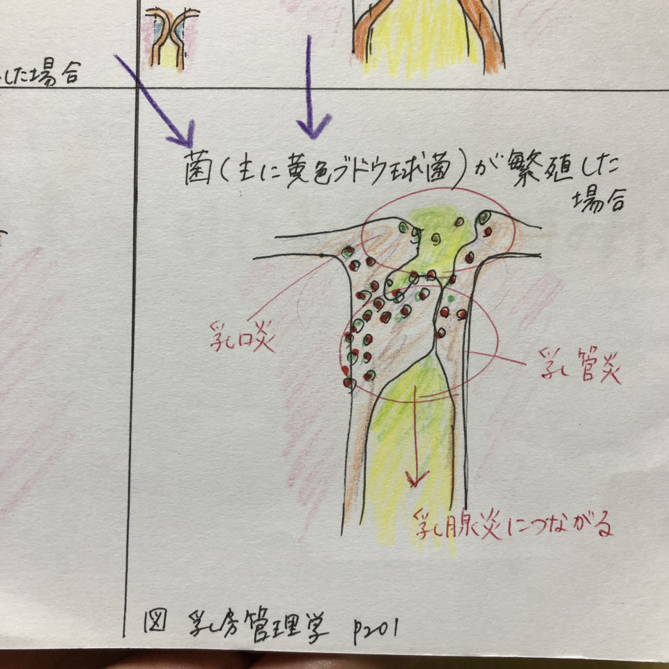 白斑が痛い あいちょ助産院