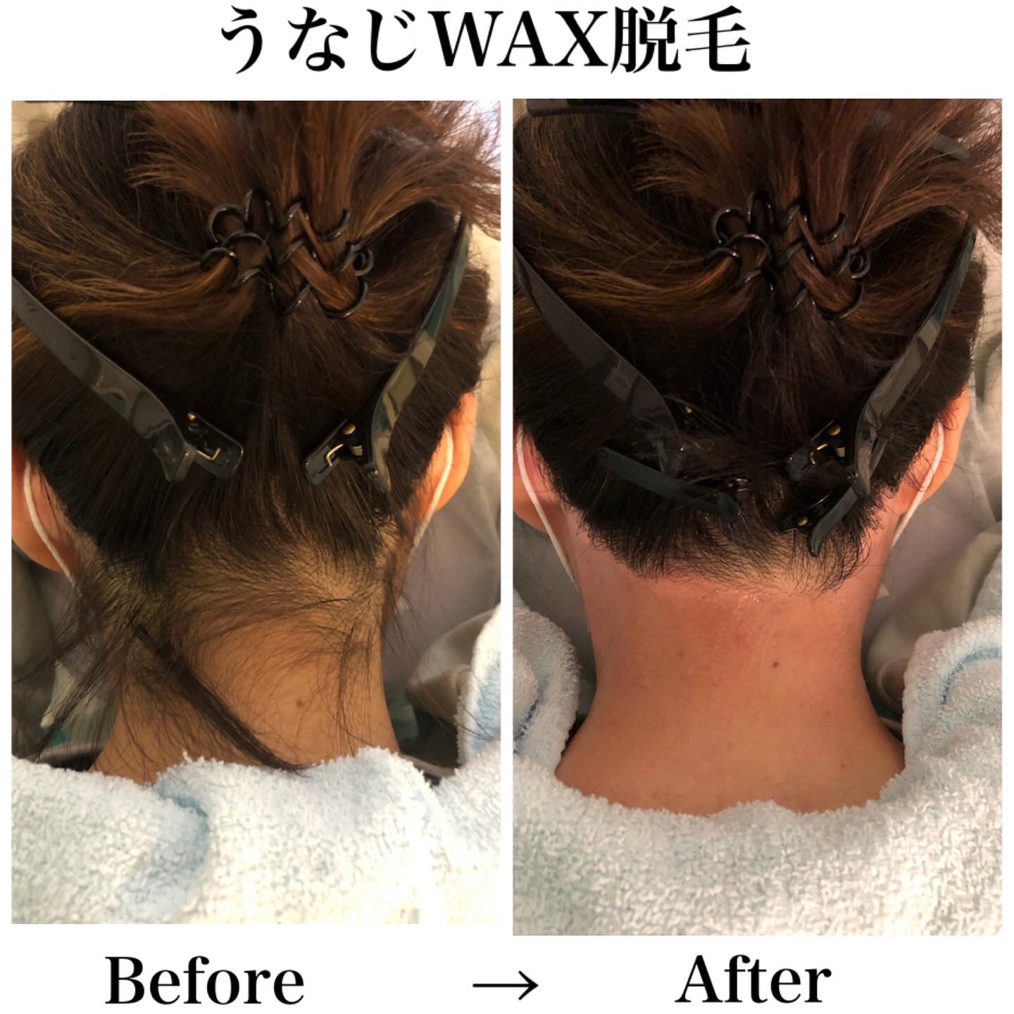 うなじ脱毛 Laugh ラフ Waxing Relaxtion