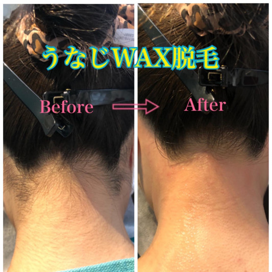 うなじビフォーアフターと Laugh ラフ Waxing Relaxtion