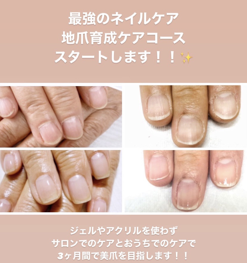 最強のネイルケア✨地爪育成ケアコースはじめます！！ | nail salon hitohira*