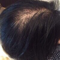 増毛エクステ ヘアエク ヘアループ 美容室で出来る育毛システムサロン 増毛エクステサロン ヘアエク ヘアループ 増毛エクステ ヘアエク ヘアループ 美容室で出来る育毛システムサロン 増毛エクステサロン ヘアエク ヘアループ