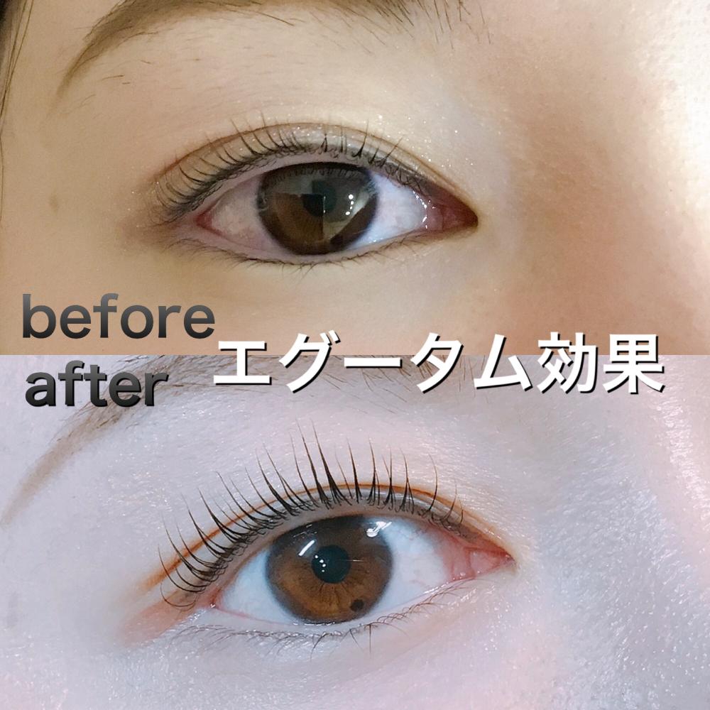 人気商品☆エグータム美容液 | 【武蔵小杉駅近くのマツエクサロン