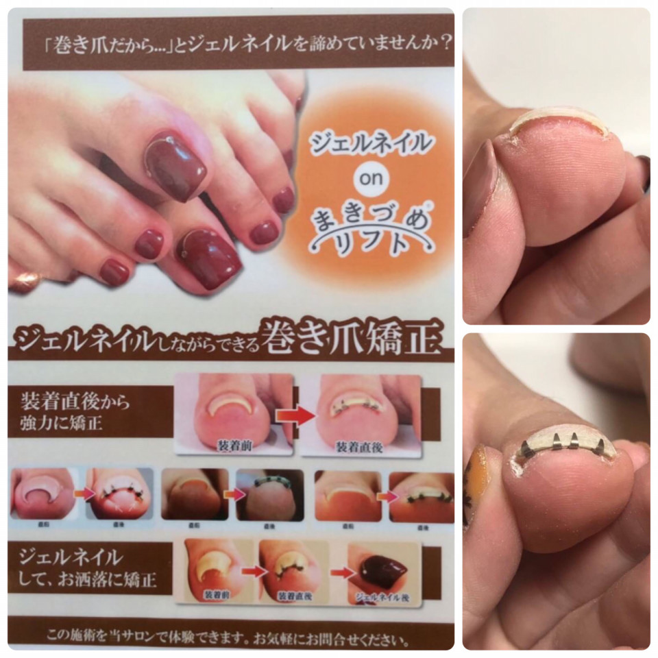 巻詰めに悩んでいる方必見 Eyelash Nail Hair Removalsalon Eyeris