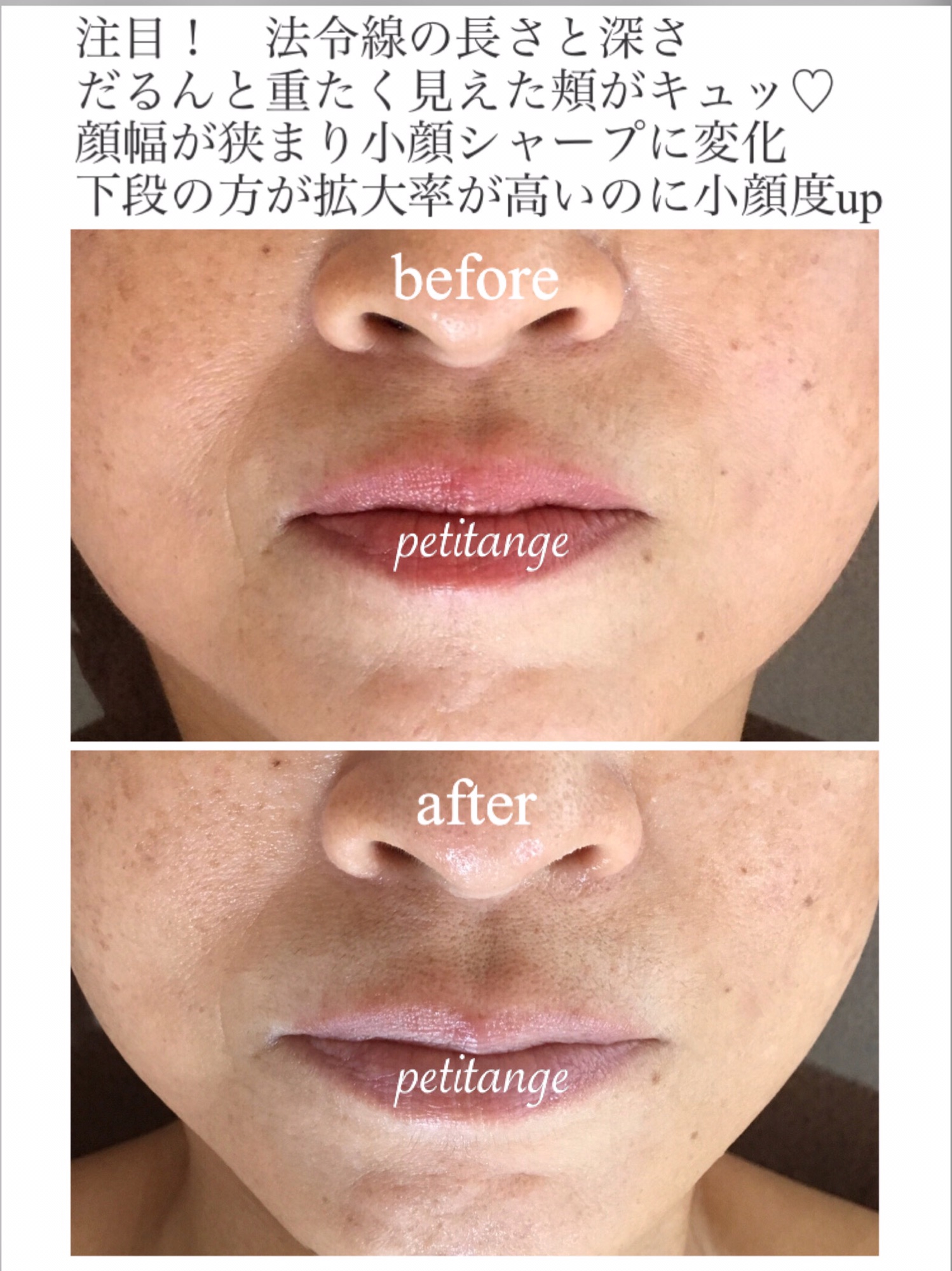 指名No.1「顔のインナーマッスルトリートメント」 | 50代からの肌と髪