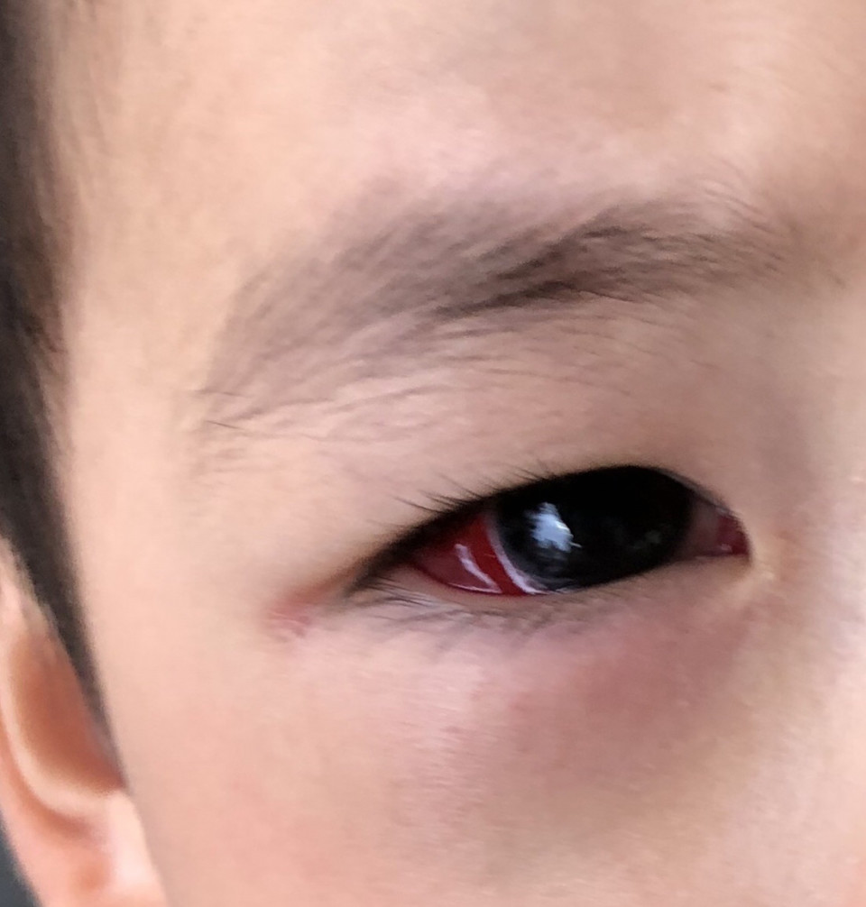 突然白目がブヨブヨに Shioli シオリ 突然白目がブヨブヨに Shioli シオリ