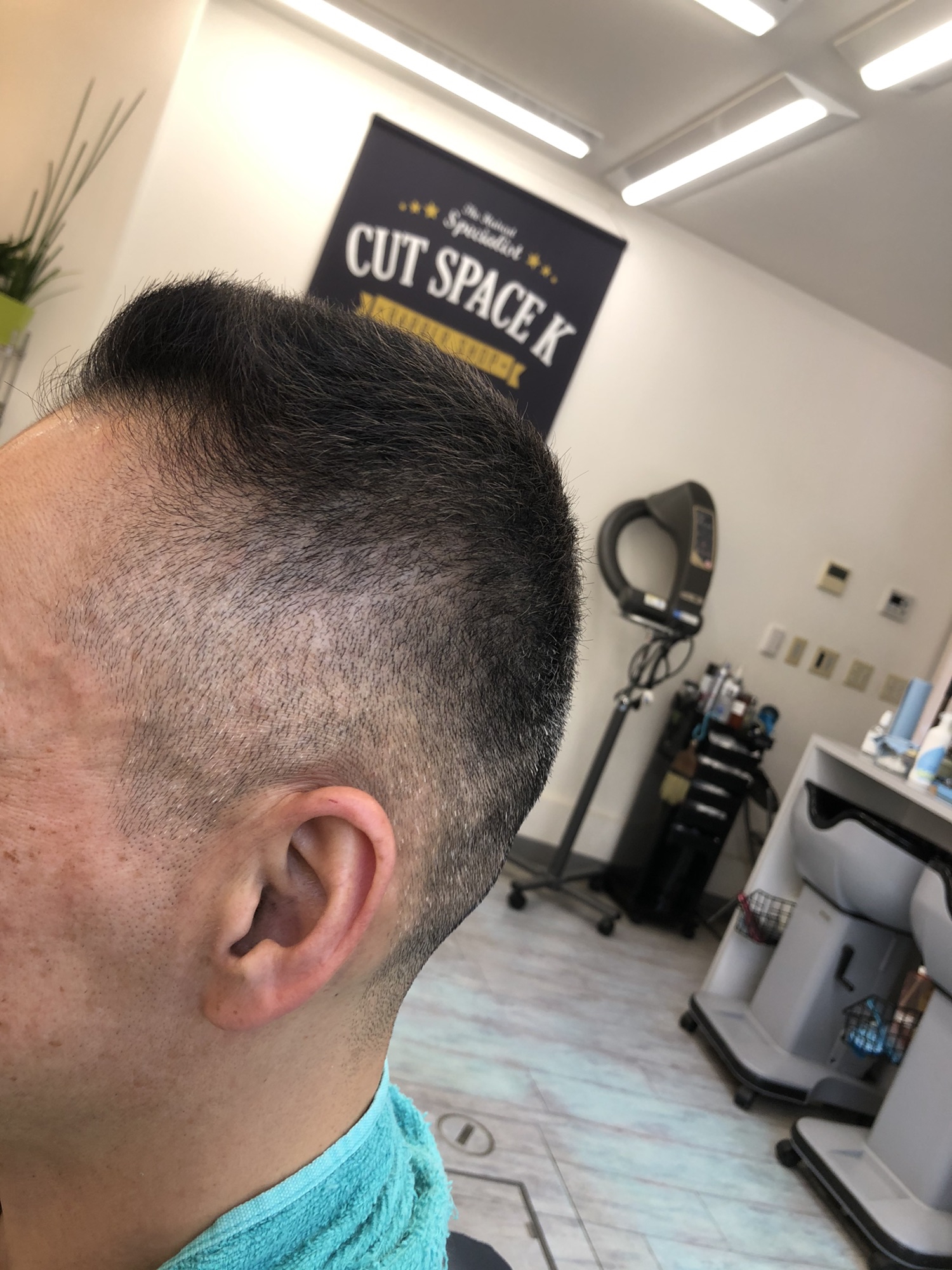 オシャレボウズ 円形脱毛症からの回復 カットスペース K Barber Shop 横浜市港南区の理容室 上永谷と下永谷の中間地にある理髪店です フェードカットやスキンフェードなどのメンズカットに定評あり 駐車場２台分完備