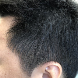毛量対策 髪の膨らみ 薄毛の対処 ページ3 カットスペース ｋ ｰ Barber Shop 横浜市港南区の理容室 上永谷と下永谷の中間地にある理髪店です フェードカットやスキンフェードなどのメンズカットに定評あり 駐車場２台分完備