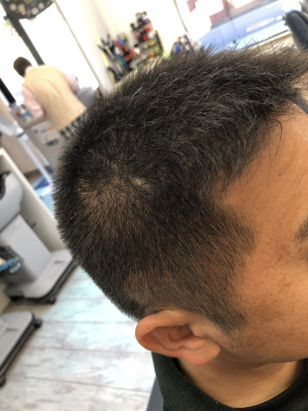 おしゃれボウズ 厚さの変更 6mm カットスペース K Barber Shop 横浜市港南区の理容室 上永谷と下永谷の中間地にある理髪店です フェードカットやスキンフェードなどのメンズカットに定評あり 駐車場２台分完備