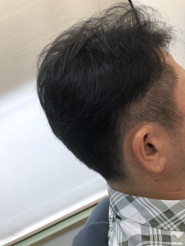 サイドツーブロックから バックの刈り上げへの繋がり カットスペース K Barber Shop 横浜市港南区の理容室 上永谷と下永谷の中間地にある理髪店です フェードカットやスキンフェードなどのメンズカットに定評あり 駐車場２台分完備