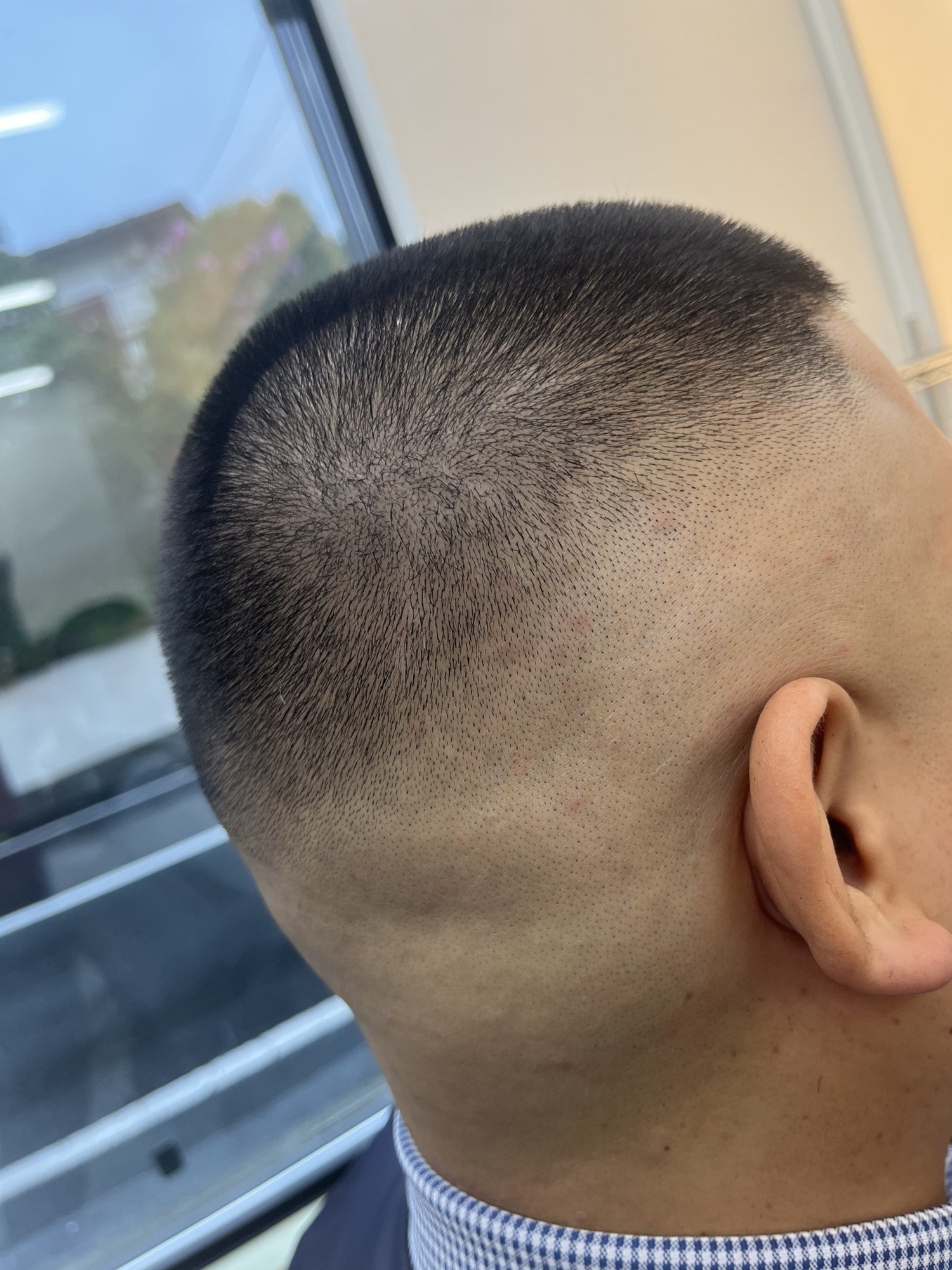 五分刈りとは, 5分刈り 何ミリ | 坊主の五厘とは?長さ別の印象と特徴を解説します。よく出ているのが、1分=3ミリ、3分=6ミリ、5分=8 ...